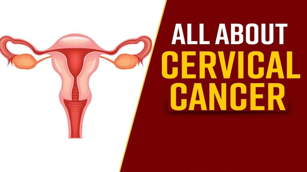 cervical cancer